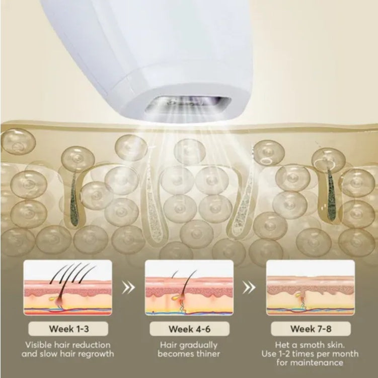 Professional IPL Laser Hair Removal facial hair treatment