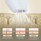 Professional IPL Laser Hair Removal facial hair treatment