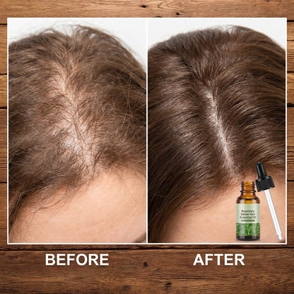 Rosemary Dense Hair Essential Oil