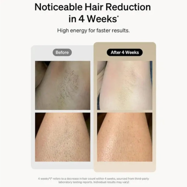 Professional IPL Laser Hair Removal home salon device
